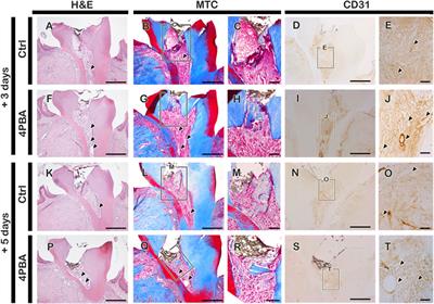 Facilitation of Reparative Dentin Using a Drug Repositioning Approach With 4-Phenylbutric Acid